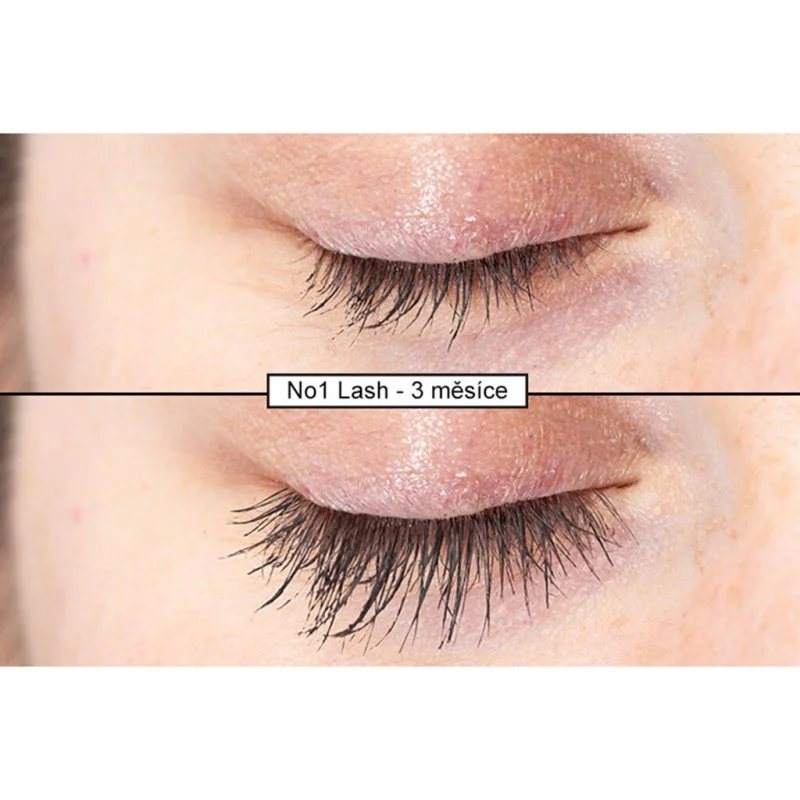 Intenzívne sérum na riasy 4 ml