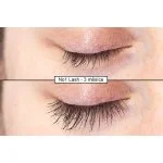 Intenzívne sérum na riasy 4 ml