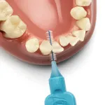 Normal medzizubné kefky 0,6 mm 8 ks