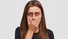 Ako na modriny pomocou overených prírodných postupov